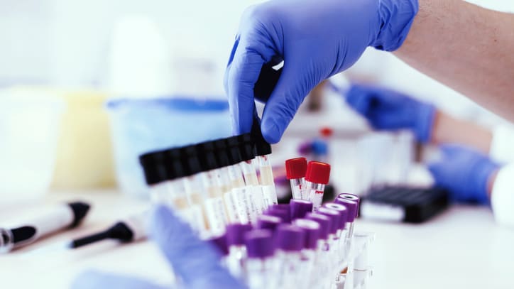 A person holding a test tube in a laboratory.