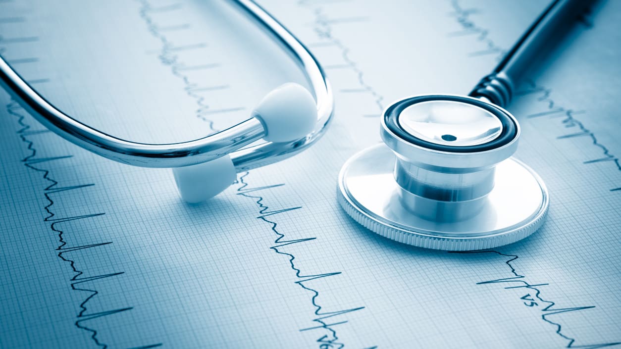 A stethoscope on top of an ecg chart.
