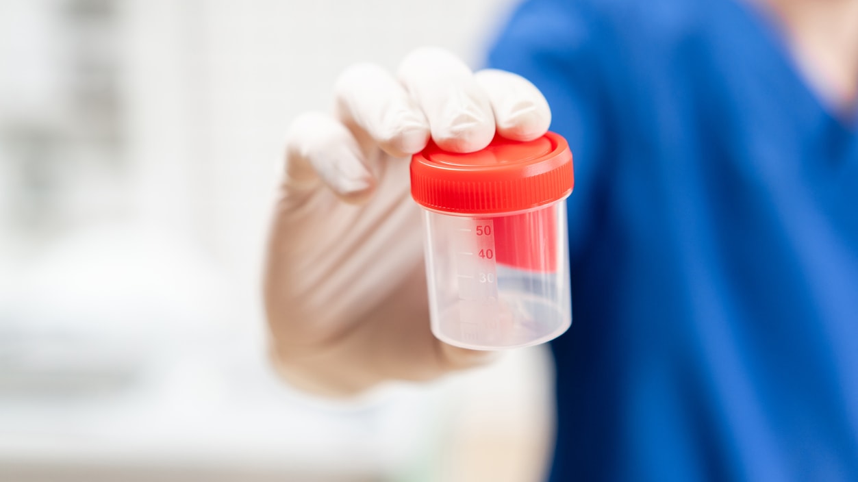 A doctor is holding a container of medicine.