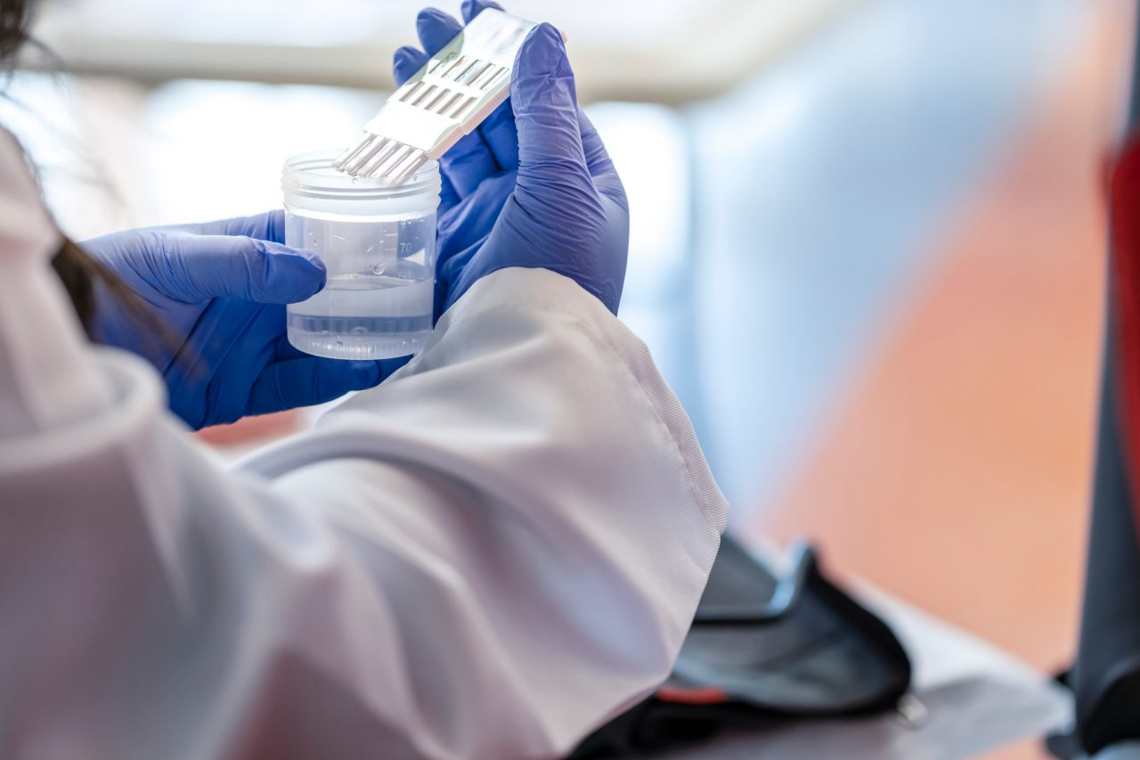 Lab tech performs a drug test