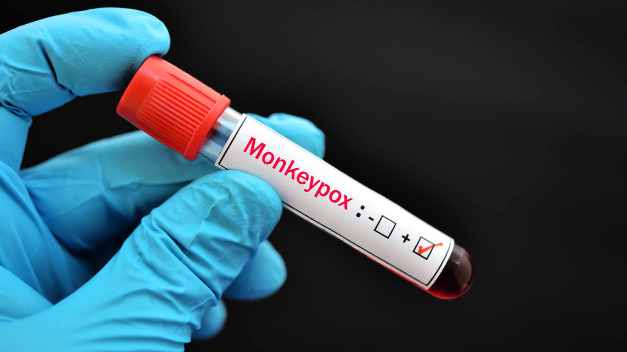 A person is holding a test tube with the word moglipox on it.