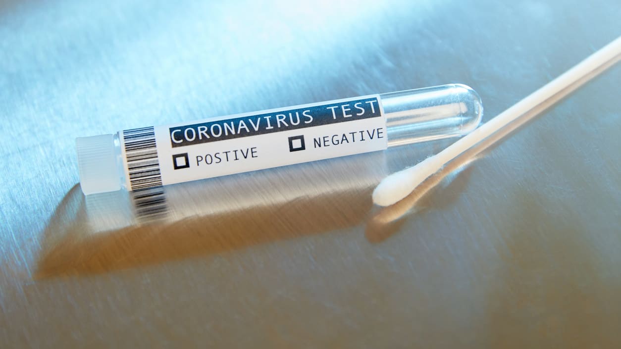 A coronavirus test tube with a positive test next to it.